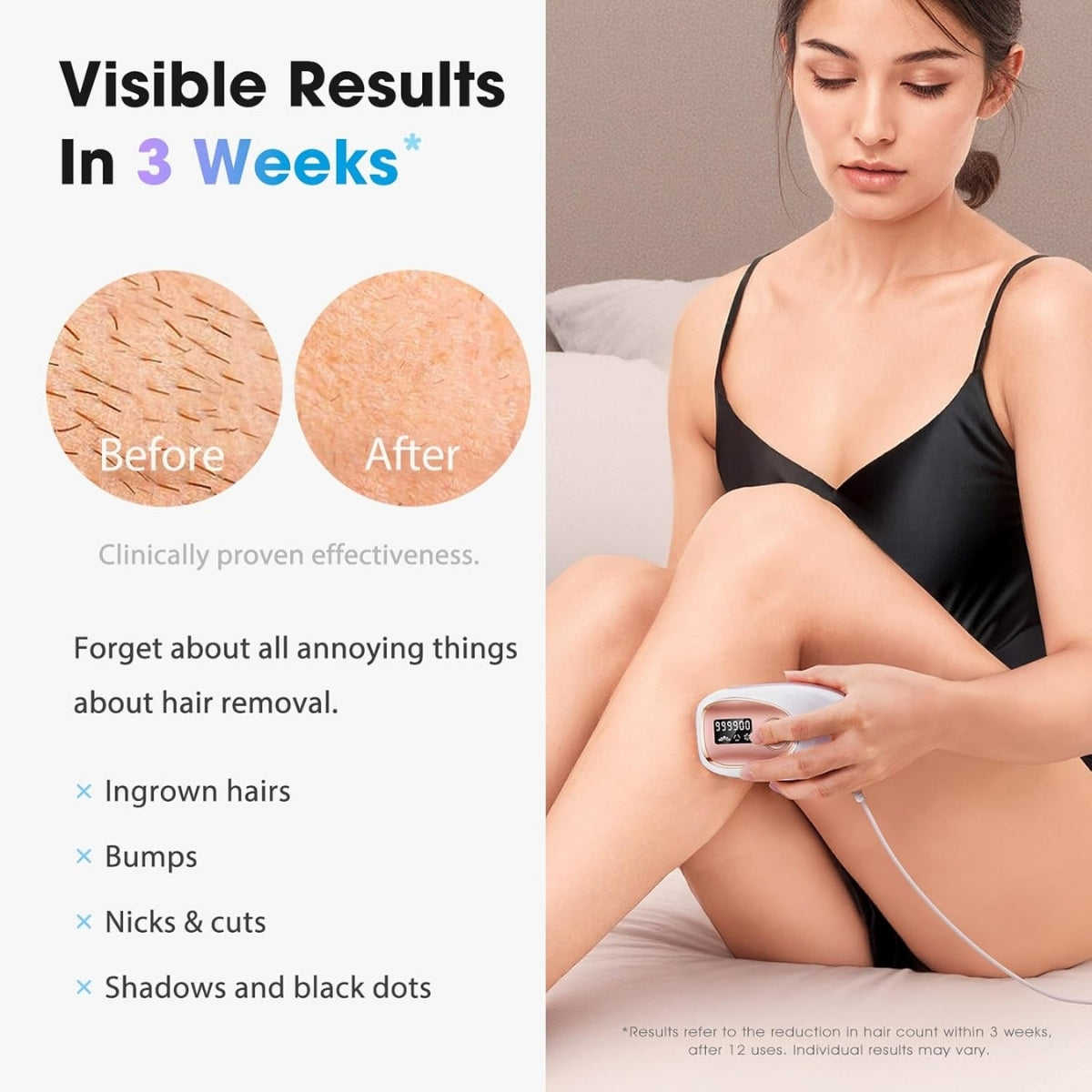Hairlessly IPL at Home Hair Removal - Halo PRO